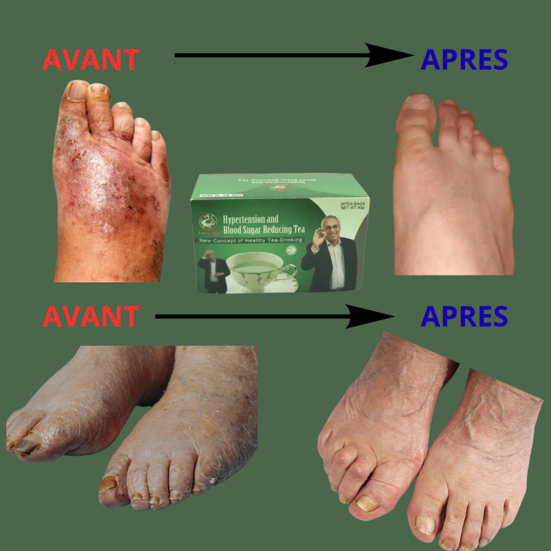Boîte de 20 Thés Anti-Diabète & Hypertension — 100% Naturel